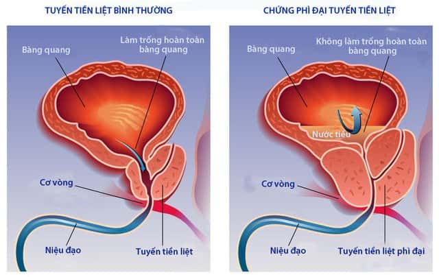 HÀNG MỸ NHẬP - CUNG CẤP SẢN PHẨM CHÍNH HÃNG MỸ
